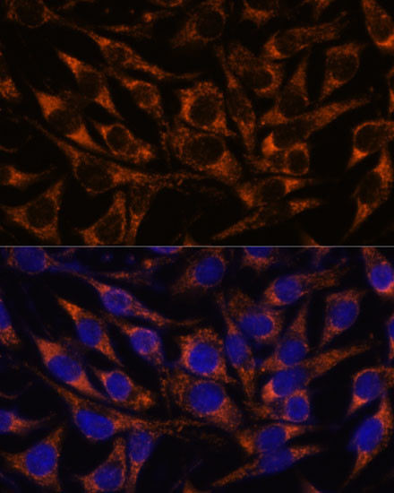 ACAA2 Antibody in Immunocytochemistry (ICC/IF)