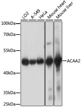 ACAA2 Antibody in Western Blot (WB)