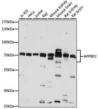 PAT1 Antibody in Western Blot (WB)