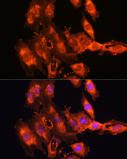 FSTL1 Antibody in Immunocytochemistry (ICC/IF)