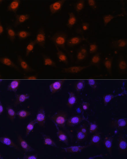 LSD1 Antibody in Immunocytochemistry (ICC/IF)