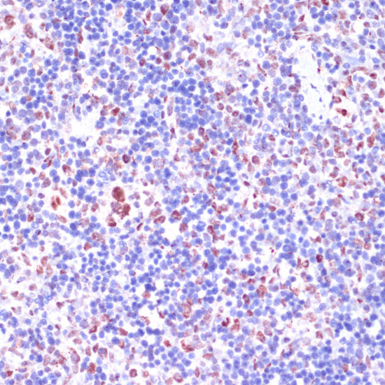 LSD1 Antibody in Immunohistochemistry (Paraffin) (IHC (P))