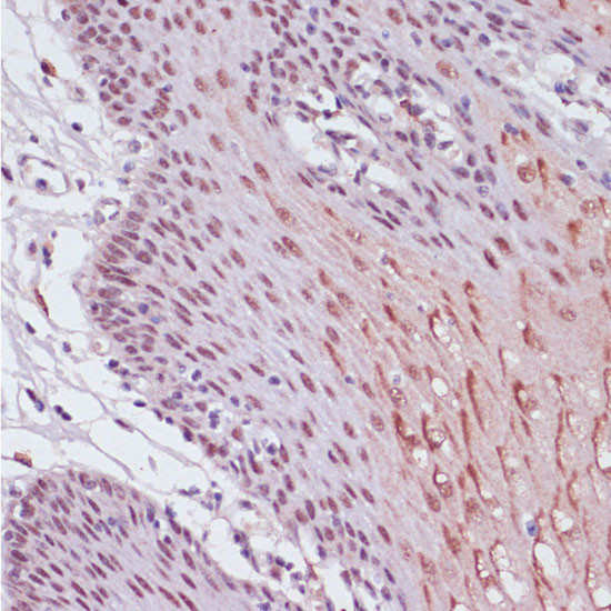 LSD1 Antibody in Immunohistochemistry (Paraffin) (IHC (P))