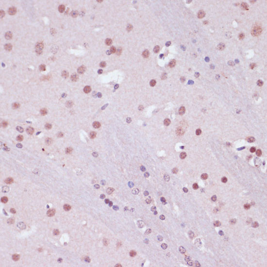 LSD1 Antibody in Immunohistochemistry (Paraffin) (IHC (P))