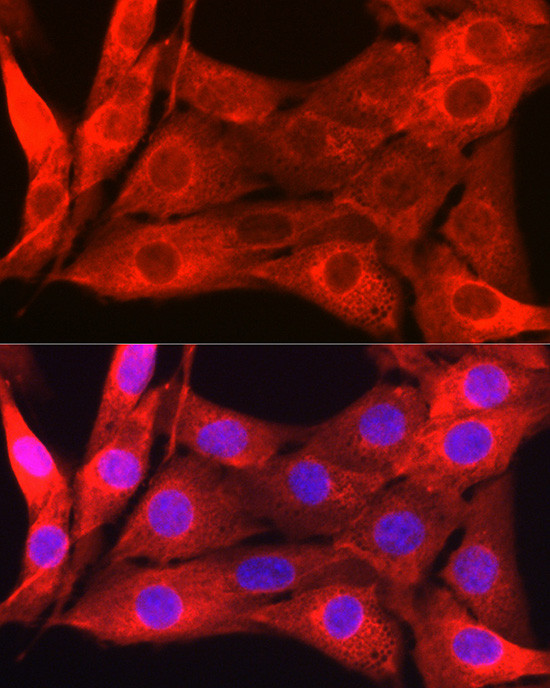 Galectin 1 Antibody in Immunocytochemistry (ICC/IF)