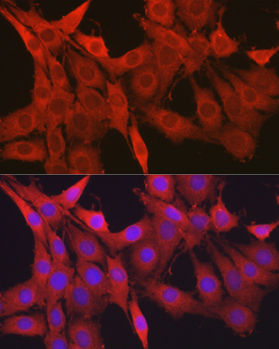 Galectin 1 Antibody in Immunocytochemistry (ICC/IF)