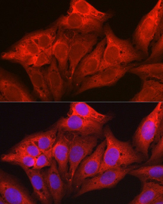 Galectin 1 Antibody in Immunocytochemistry (ICC/IF)