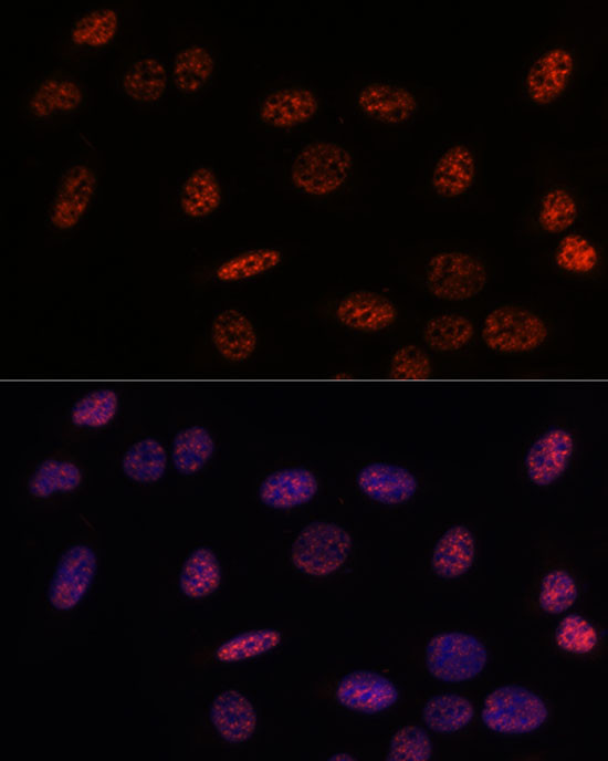 SF3B1 Antibody in Immunocytochemistry (ICC/IF)