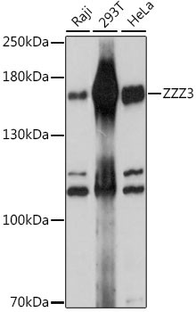 ZZZ3 Antibody in Western Blot (WB)