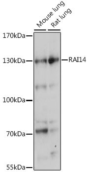 RAI14 Antibody in Western Blot (WB)