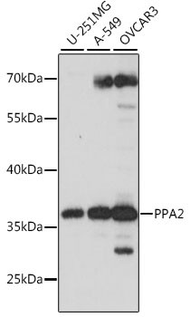 PPA2 Antibody in Western Blot (WB)