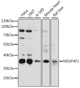 NDUFAF1 Antibody in Western Blot (WB)