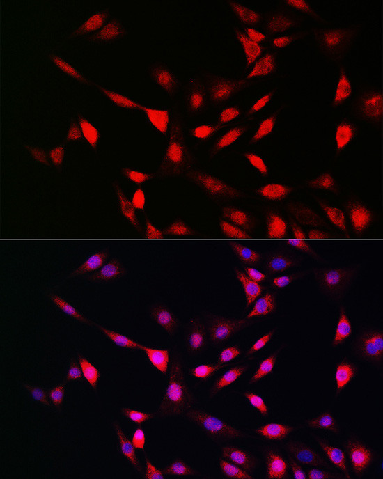 UFM1 Antibody in Immunocytochemistry (ICC/IF)