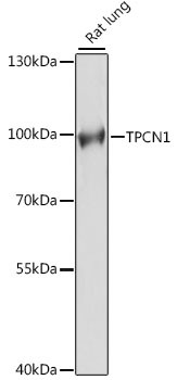 TPCN1 Antibody in Western Blot (WB)