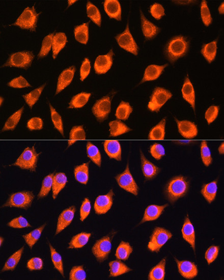 LMBRD1 Antibody in Immunocytochemistry (ICC/IF)