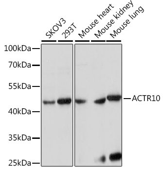 ACTR10 Antibody in Western Blot (WB)