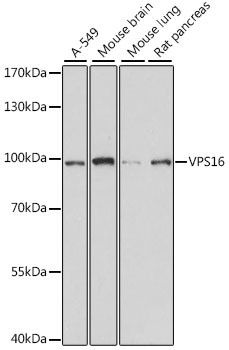 VPS16 Antibody in Western Blot (WB)