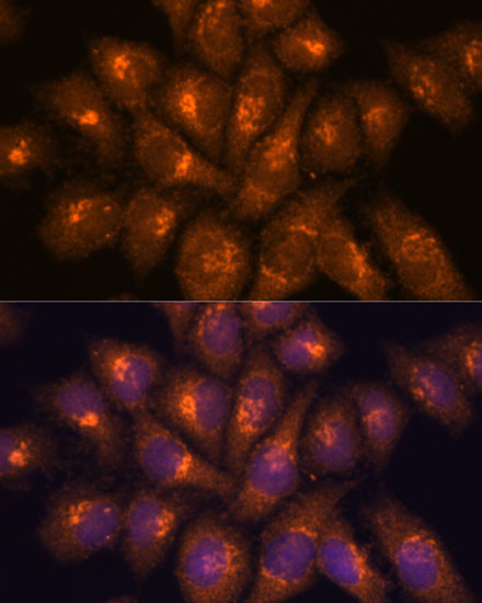 B3GNT4 Antibody in Immunocytochemistry (ICC/IF)