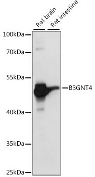 B3GNT4 Antibody in Western Blot (WB)