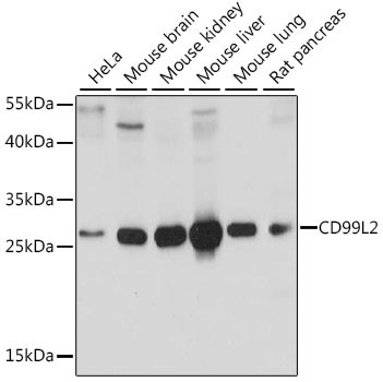 CD99L2 Antibody in Western Blot (WB)