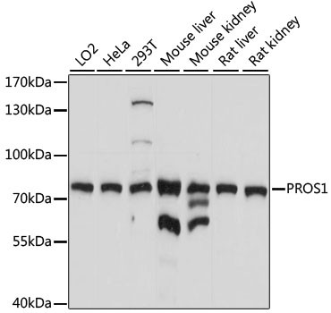 PROTEIN S Antibody in Western Blot (WB)