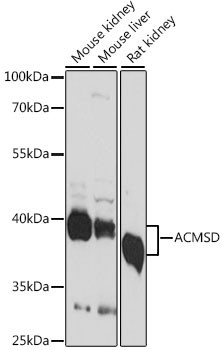 ACMSD Antibody in Western Blot (WB)