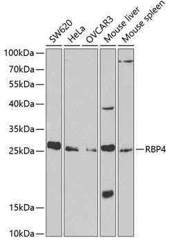 RBP4 Antibody in Western Blot (WB)