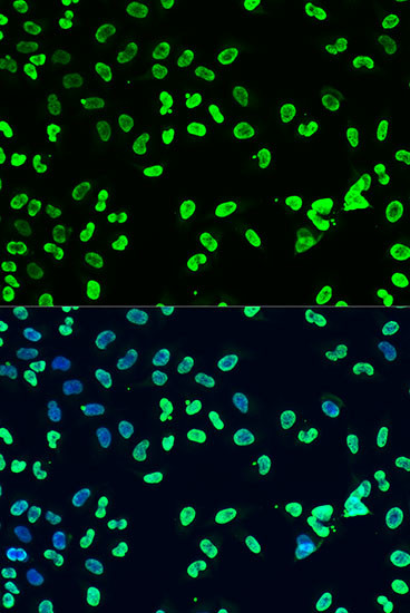 Di-Methyl-DNMT3A (Lys44) Antibody in Immunocytochemistry (ICC/IF)