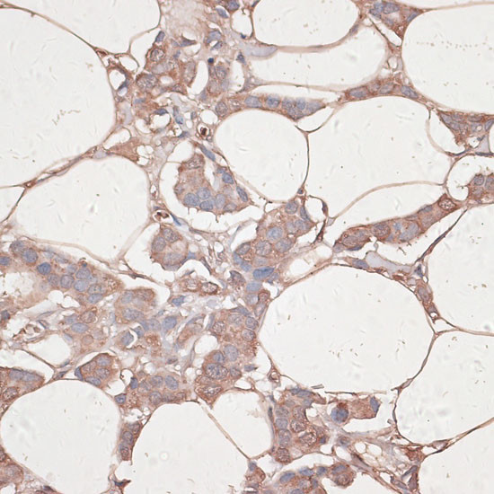 Laminin gamma-1 Antibody in Immunohistochemistry (Paraffin) (IHC (P))