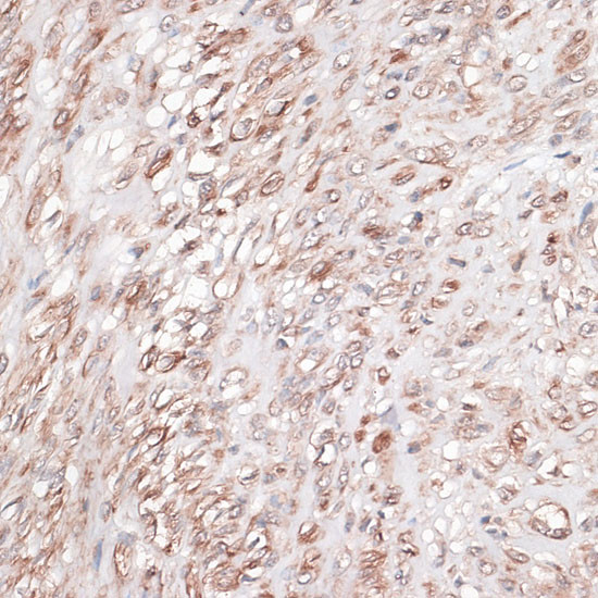 Laminin gamma-1 Antibody in Immunohistochemistry (Paraffin) (IHC (P))