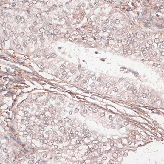 Laminin gamma-1 Antibody in Immunohistochemistry (Paraffin) (IHC (P))