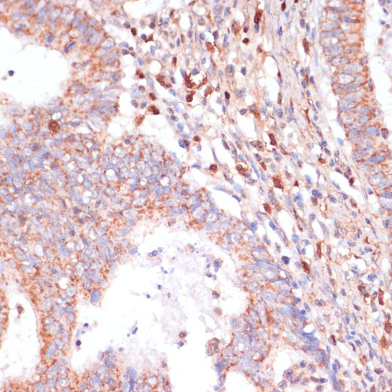 CACNB2 Antibody in Immunohistochemistry (Paraffin) (IHC (P))