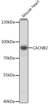 CACNB2 Antibody in Western Blot (WB)