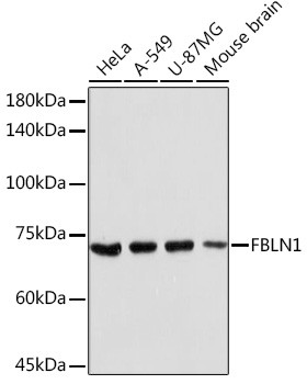 Fibulin 1 Antibody in Western Blot (WB)