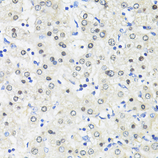 TRIM27 Antibody in Immunohistochemistry (Paraffin) (IHC (P))