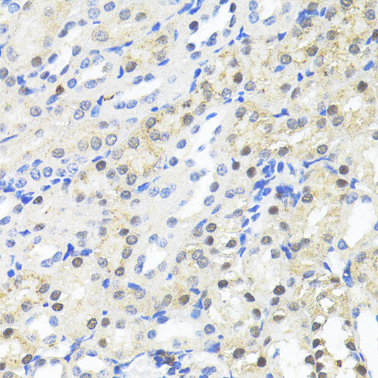 TRIM27 Antibody in Immunohistochemistry (Paraffin) (IHC (P))