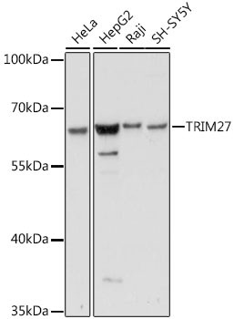 TRIM27 Antibody in Western Blot (WB)