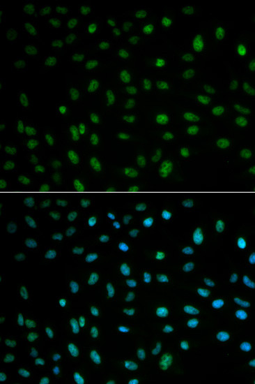 HuR Antibody in Immunocytochemistry (ICC/IF)