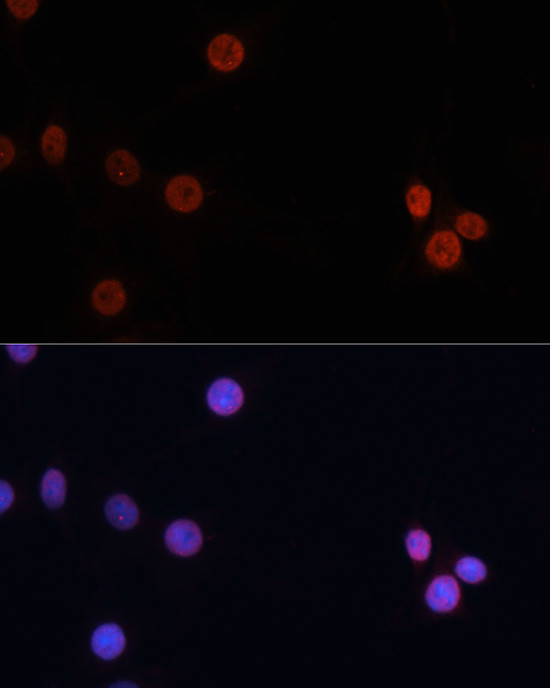 DNMT3B Antibody in Immunocytochemistry (ICC/IF)