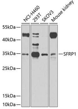 SFRP1 Antibody in Western Blot (WB)