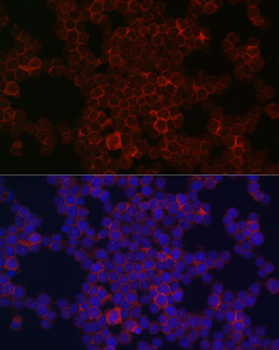 CSF1R Antibody in Immunocytochemistry (ICC/IF)