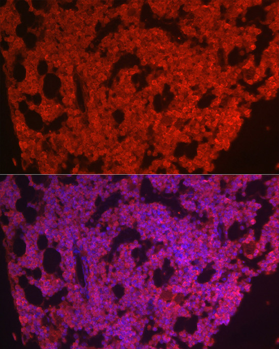 CSF1R Antibody in Immunocytochemistry (ICC/IF)