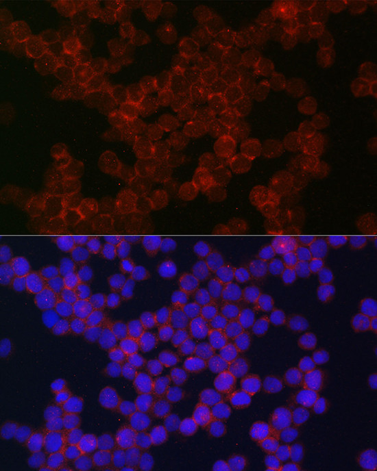 CSF1R Antibody in Immunocytochemistry (ICC/IF)