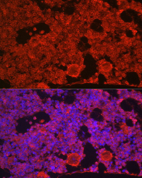 CSF1R Antibody in Immunocytochemistry (ICC/IF)