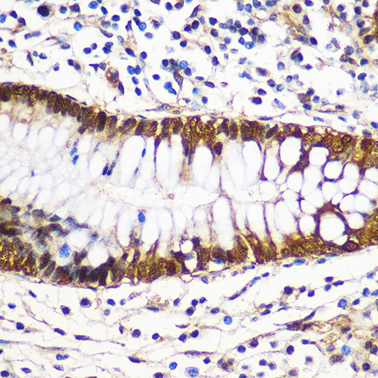 14-3-3 gamma Antibody in Immunohistochemistry (Paraffin) (IHC (P))