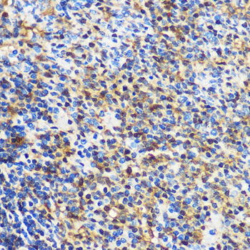 14-3-3 gamma Antibody in Immunohistochemistry (Paraffin) (IHC (P))