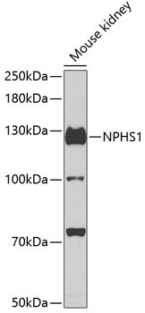 Nephrin Antibody in Western Blot (WB)