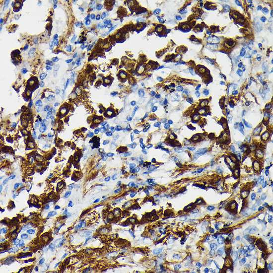 SFTPA1 Antibody in Immunohistochemistry (Paraffin) (IHC (P))