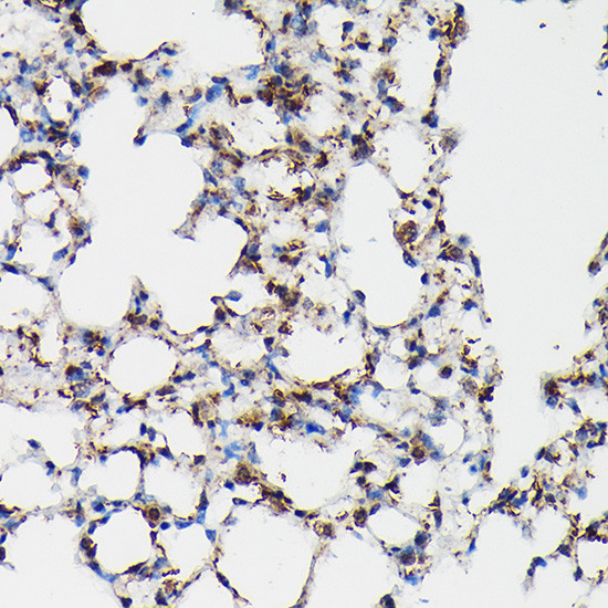 SFTPA1 Antibody in Immunohistochemistry (Paraffin) (IHC (P))