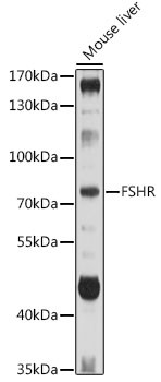 FSHR Antibody in Western Blot (WB)